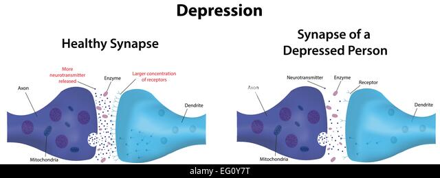 Depression Synapse Stock Photo, Royalty Free Image: 78697356 - Alamy